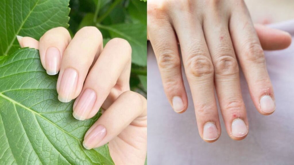 Nails can reflect overall health